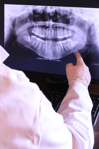 Best Emergency Gum Treatment in Eslon, CA